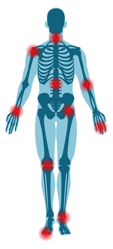 Ledproblemer Illustration
